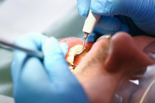Best Knocked-Out Tooth Emergency  in Redwood Falls, MN